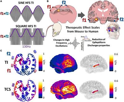 Focal non-invasive deep-brain stimulation with temporal interference for the suppression of epileptic biomarkers